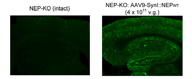 Spreading AAV vector throughout rats brain through the blood vessel
