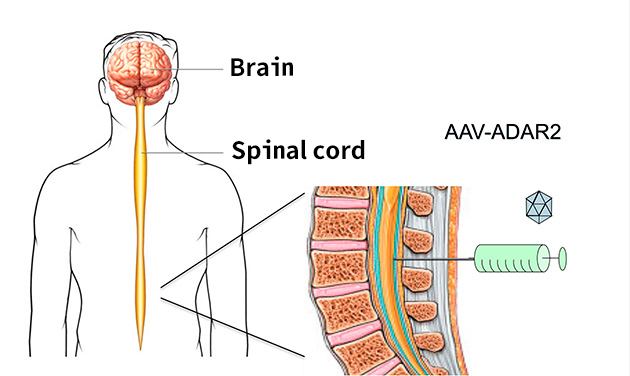 Conquer ALS by introducing AAV vector from the cavity in the spinal cord